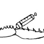 ভেন্ট্রাল সাইনাস থেকে হিমোলিক্ষ সংগ্রহ